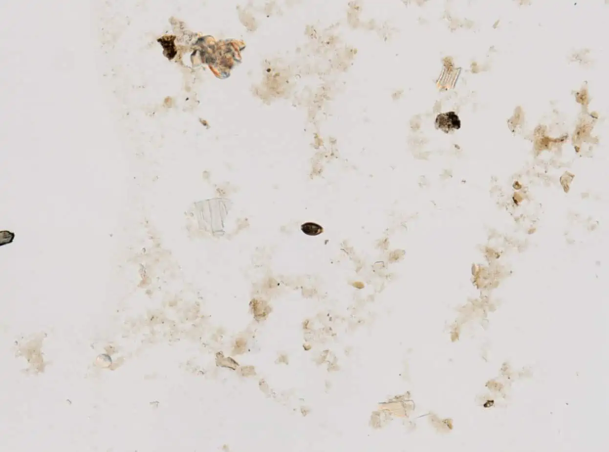 Bugs That Leave Brown Stains On Walls Homely Baron